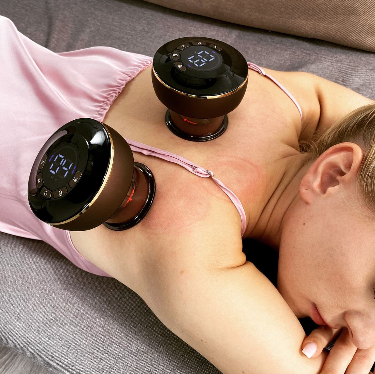 Electric Vacuum Cupping