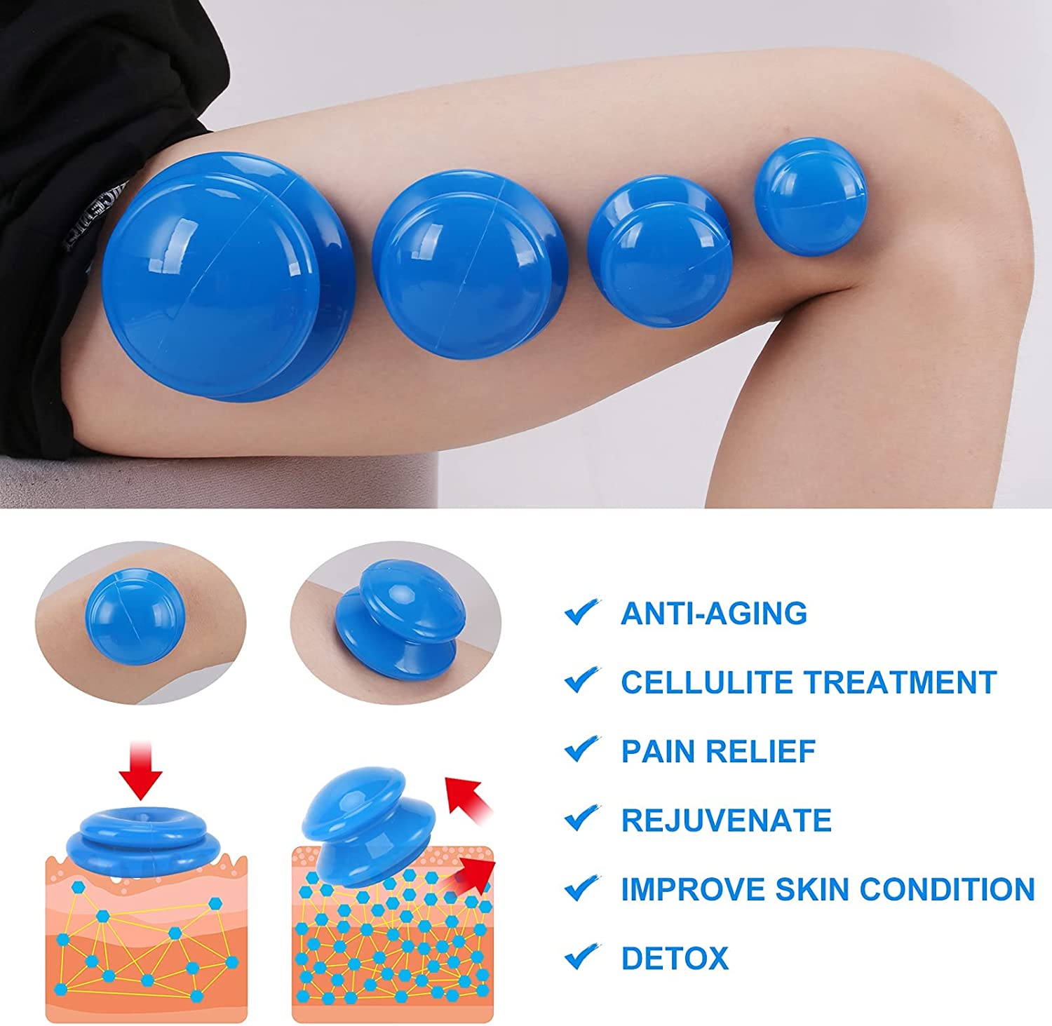 Cupping Therapy Set